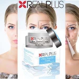 Products In Demand 2016 OEM Cosmetics Fantastic Result Green Tea Acne Treatment