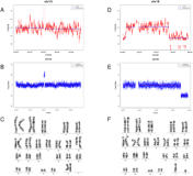 Performance Evaluation of NIPT in Detection of Chromosomal Copy Number Variants Using...
