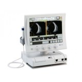 Ultrasound A / B Scanner & Biometer Tomey UD-8000