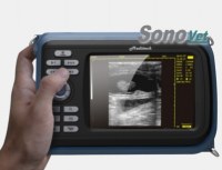 Ultrasound scanner - Sonovet