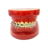 Orthodontic Model
