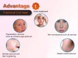 CO2 Fractional Laser: Essential Things You Should Know About Acne Scar Treatment