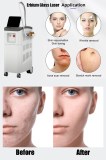 Erbiun glass laser machine for surgical scars