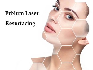 Erbium Laser Resurfacing Treatment Work