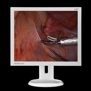 19-inch medical endoscopy system monitors