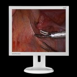 19-inch medical endoscopy system monitors