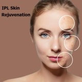 IPL Skin Rejuvenation Treatments Are Trending