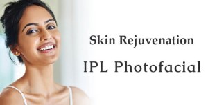 Make the first step to blemish-free and younger skin with IPL photofacial machine