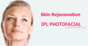 IPL Photo Facial Rejuvenation