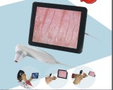 Computer use tablet use and smart phone use skin detector skin analyser