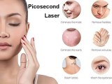Picosecond Pricing vs. Other Lasers