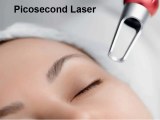 Making The Most Out Of Picosecond Laser Treatment