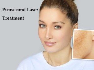 Possible Outcomes of Picosecond Laser Treatments