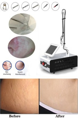 CO2 fractional laser facial treatment range