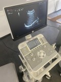 Esaote MyLab X5 Ultrasound Imaging