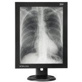 3 megapixel medical monochrome LCD display monitors for hospital