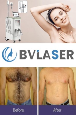 The best permanent laser hair removal machine